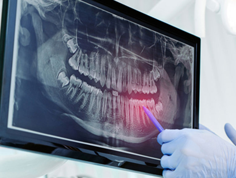 AI-Powered X-Rays