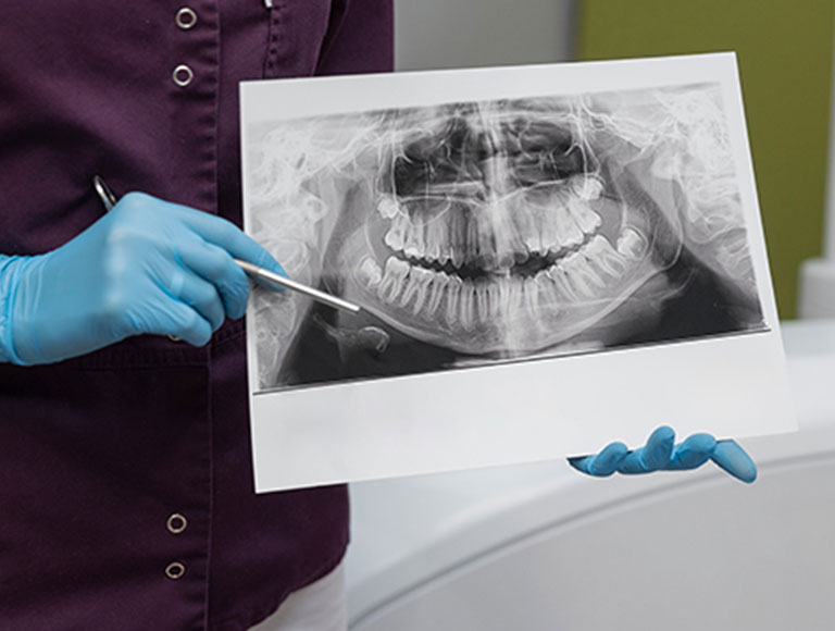 Digital Dental X-Rays