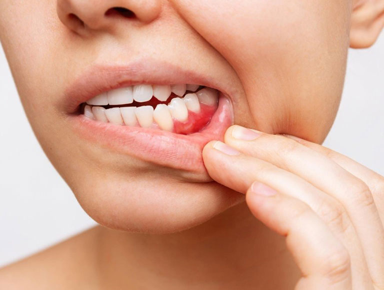 Protect Your Gums, Protect Your Health