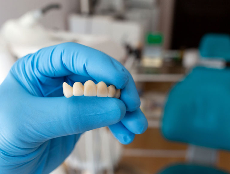 Dental Bridge