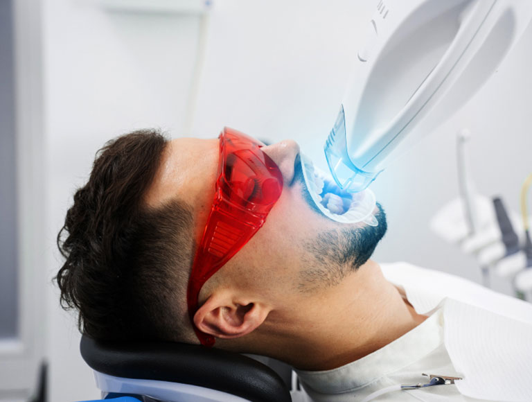 Teeth Whitening