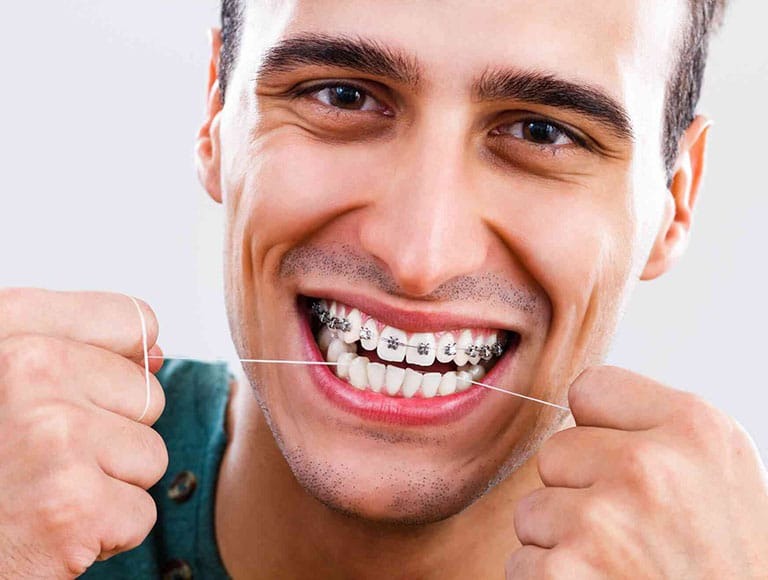 Who Should Consider Metal Braces?