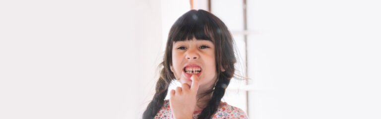 What Dental Insurance Covers Implants for Missing Teeth?