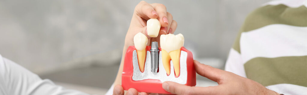 Why Is My Dental Implant Throbbing? 6 Possible Reasons