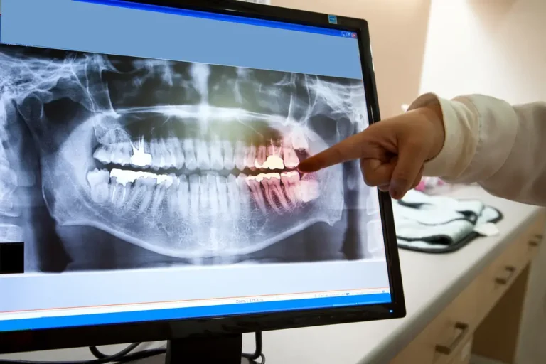 Advanced Technology at Elite Dental: Enhancing Patient Comfort and Care